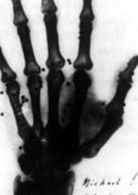 123_rontgen_kep_00-1-b-13